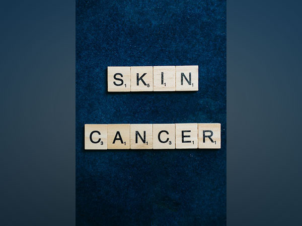 Researchers reveal how some skin cancer resist treatment – World News Network